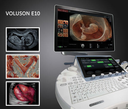fetal imaging